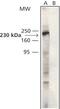 Catenin delta-1 antibody, PA1-25156, Invitrogen Antibodies, Western Blot image 