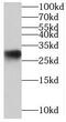 Mediator Complex Subunit 8 antibody, FNab05099, FineTest, Western Blot image 