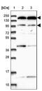 POM121 Transmembrane Nucleoporin C antibody, NBP2-14531, Novus Biologicals, Western Blot image 