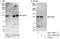Ubiquitin carboxyl-terminal hydrolase 20 antibody, A301-189A, Bethyl Labs, Immunoprecipitation image 