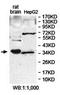 Lactate Dehydrogenase A Like 6A antibody, orb78378, Biorbyt, Western Blot image 