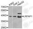 LDL Receptor Related Protein Associated Protein 1 antibody, A3004, ABclonal Technology, Western Blot image 