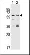 Solute carrier family 22 member 4 antibody, LS-B10568, Lifespan Biosciences, Western Blot image 