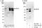 Deformed epidermal autoregulatory factor 1 homolog antibody, A303-187A, Bethyl Labs, Western Blot image 