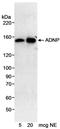 Activity Dependent Neuroprotector Homeobox antibody, A300-104A, Bethyl Labs, Western Blot image 