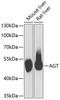 Angiotensin I antibody, GTX33009, GeneTex, Western Blot image 