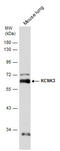 Potassium channel subfamily K member 3 antibody, GTX132622, GeneTex, Western Blot image 