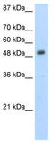 Desmin antibody, TA346083, Origene, Western Blot image 
