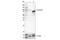 Catenin Beta 1 antibody, 9587T, Cell Signaling Technology, Western Blot image 