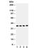 PIN2 (TERF1) Interacting Telomerase Inhibitor 1 antibody, R32303, NSJ Bioreagents, Western Blot image 