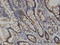Arginyl-TRNA Synthetase antibody, LS-C133937, Lifespan Biosciences, Immunohistochemistry paraffin image 
