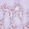 MAGE Family Member A11 antibody, orb73370, Biorbyt, Immunohistochemistry paraffin image 