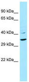 Keratin 9 antibody, TA338383, Origene, Western Blot image 