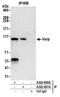 Ankyrin Repeat Domain 27 antibody, A302-997A, Bethyl Labs, Immunoprecipitation image 