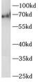 LYN Proto-Oncogene, Src Family Tyrosine Kinase antibody, FNab04904, FineTest, Western Blot image 
