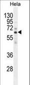 Hyaluronidase-2 antibody, LS-C165093, Lifespan Biosciences, Western Blot image 