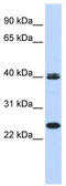 Mesoderm Posterior BHLH Transcription Factor 1 antibody, TA345259, Origene, Western Blot image 