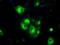 Glucose 1-dehydrogenase antibody, NBP2-02615, Novus Biologicals, Immunocytochemistry image 