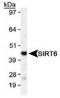 Sirtuin 6 antibody, TA301524, Origene, Western Blot image 