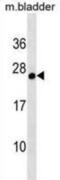 Glutathione S-transferase A3 antibody, abx030931, Abbexa, Western Blot image 