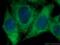 Clathrin Heavy Chain antibody, 66487-1-Ig, Proteintech Group, Immunofluorescence image 