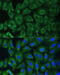 YTH N6-Methyladenosine RNA Binding Protein 1 antibody, 14-875, ProSci, Immunofluorescence image 