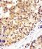 Valosin Containing Protein antibody, M00610-1, Boster Biological Technology, Immunohistochemistry paraffin image 