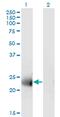 Membrane Spanning 4-Domains A12 antibody, MA5-24481, Invitrogen Antibodies, Western Blot image 