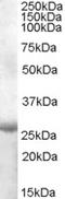 Apolipoprotein B MRNA Editing Enzyme Catalytic Subunit 2 antibody, EB08444, Everest Biotech, Western Blot image 