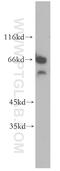 Chromodomain Y Like antibody, 17763-1-AP, Proteintech Group, Western Blot image 
