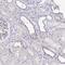 Leukocyte Receptor Cluster Member 9 antibody, PA5-62454, Invitrogen Antibodies, Immunohistochemistry paraffin image 