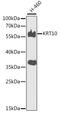 Keratin 10 antibody, 23-272, ProSci, Western Blot image 
