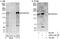 FA Complementation Group D2 antibody, A302-174A, Bethyl Labs, Immunoprecipitation image 