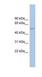 Ankyrin Repeat Domain 13D antibody, NBP1-70408, Novus Biologicals, Western Blot image 