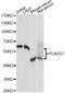 Phospholipase A2 Group VII antibody, LS-C748883, Lifespan Biosciences, Western Blot image 