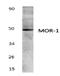 Mor antibody, AP01331PU-N, Origene, Western Blot image 