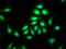 Centrosomal Protein 135 antibody, LS-C671755, Lifespan Biosciences, Immunofluorescence image 