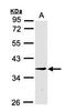 Keratin 33B antibody, orb73372, Biorbyt, Western Blot image 