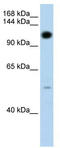 Pumilio homolog 2 antibody, TA343828, Origene, Western Blot image 