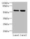 EF-Hand Calcium Binding Domain 14 antibody, A58898-100, Epigentek, Western Blot image 