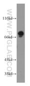 G Protein Signaling Modulator 1 antibody, 11483-1-AP, Proteintech Group, Western Blot image 