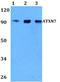 Ataxin 7 antibody, A02936, Boster Biological Technology, Western Blot image 