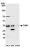 Twinfilin Actin Binding Protein 1 antibody, A305-278A, Bethyl Labs, Western Blot image 