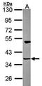 Homer Scaffold Protein 3 antibody, orb73869, Biorbyt, Western Blot image 