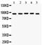 EWS RNA Binding Protein 1 antibody, PA5-79225, Invitrogen Antibodies, Western Blot image 