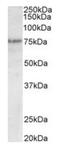 Tumor Protein P63 antibody, orb12357, Biorbyt, Western Blot image 