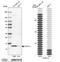 Dynein Light Chain Tctex-Type 3 antibody, NBP1-80698, Novus Biologicals, Western Blot image 