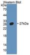 Nuclear Receptor Subfamily 5 Group A Member 2 antibody, LS-C373225, Lifespan Biosciences, Western Blot image 