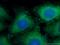 Fascin Actin-Bundling Protein 1 antibody, 66321-1-Ig, Proteintech Group, Immunofluorescence image 