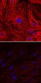 Uncoupling Protein 1 antibody, MAB6158, R&D Systems, Immunofluorescence image 